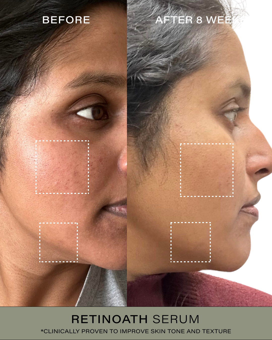 The Overnight Renewal Duo