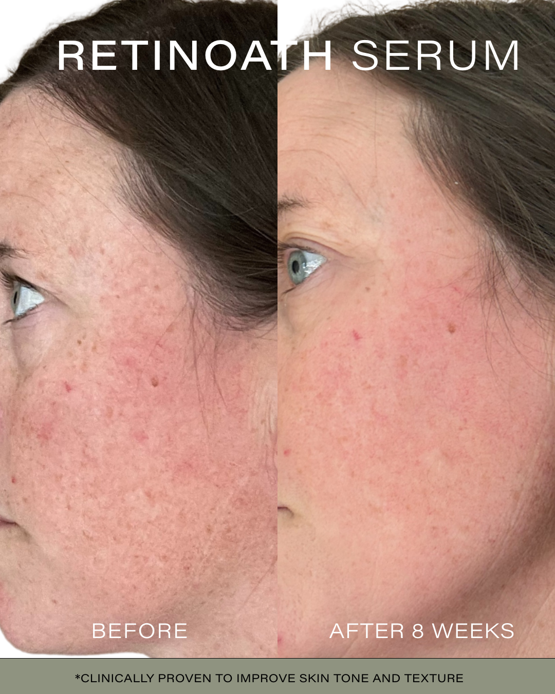 Limited Edition Age Defying Trio