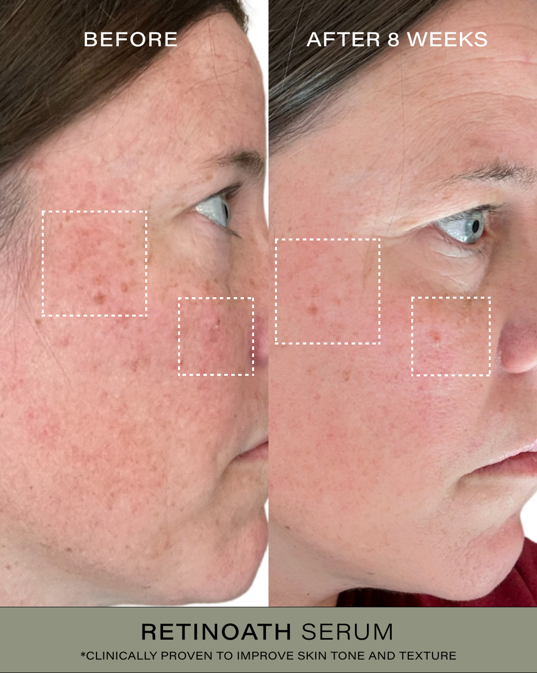 Limited Edition Age Defying Trio