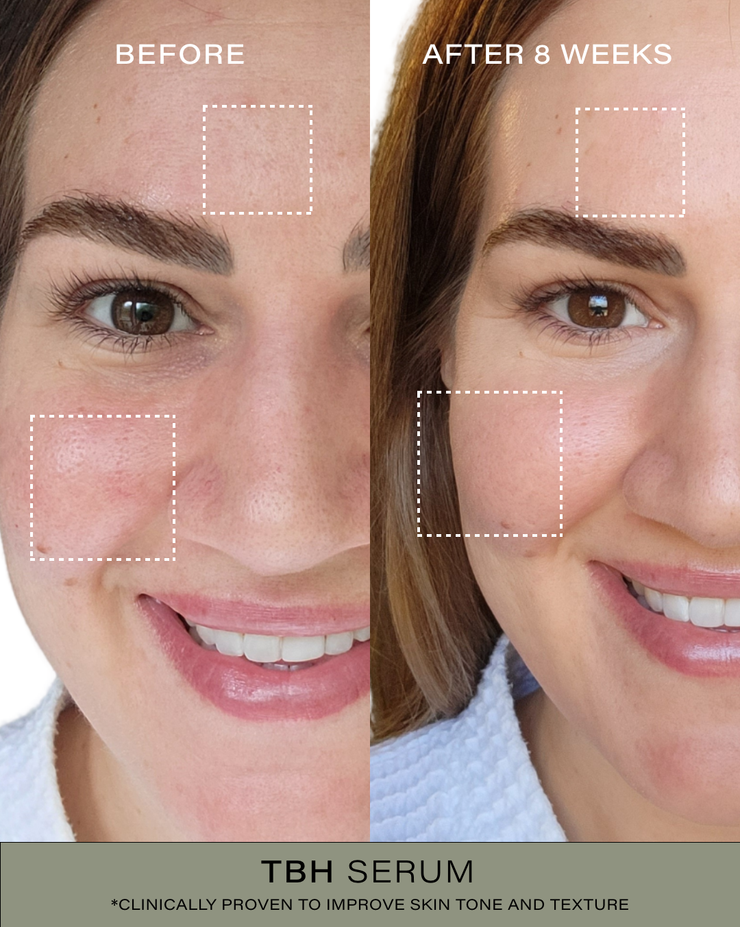 Limited Edition Clear Skin Trio