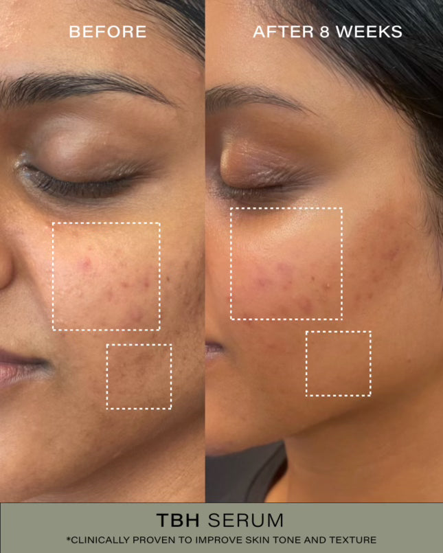 Limited Edition Clear Skin Trio